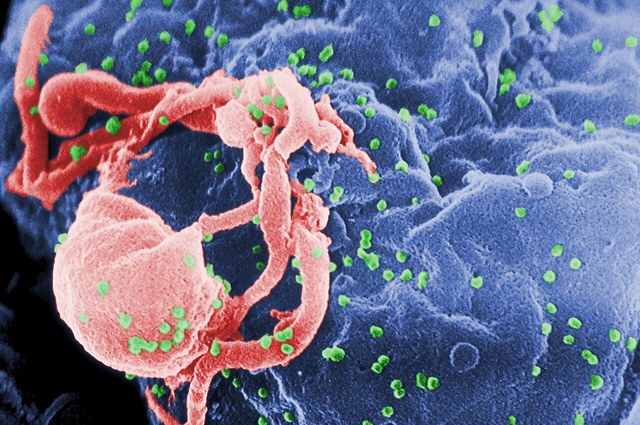 Human Immunodeficiency Virus