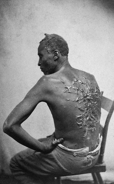 Slavery